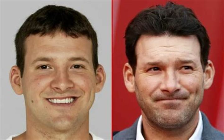 Tony Romo Plastic Surgery: The Speculations and Facts About Plastic Surgery Journey