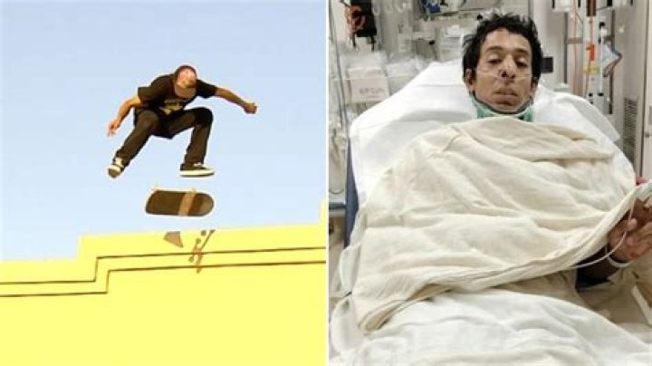 Tony Willie: The Unfortunate Event, Accident, Bone Injury, Skating Accident, Viral Video, Lucky To Be Alive, Health Check And Other Updates 