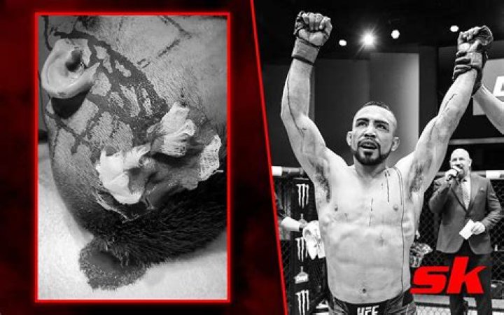 UFC star Garcia cuts artery in head mid fight but still WINS as medics take 2 HOURS to stop bleeding in horror scenes