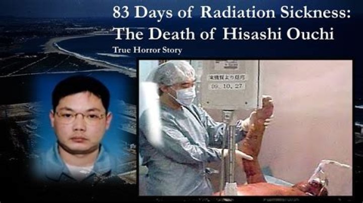 Understanding Hasashi Ouchi: The Tragic Case Of A Radiation Accident Victim
