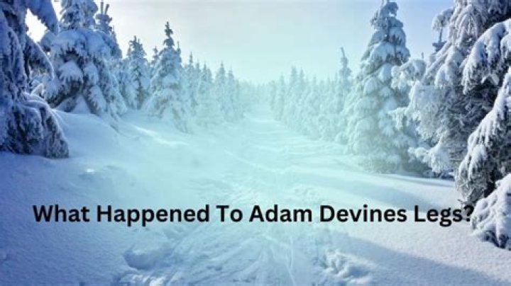 What Happened To Adam Devines Legs?