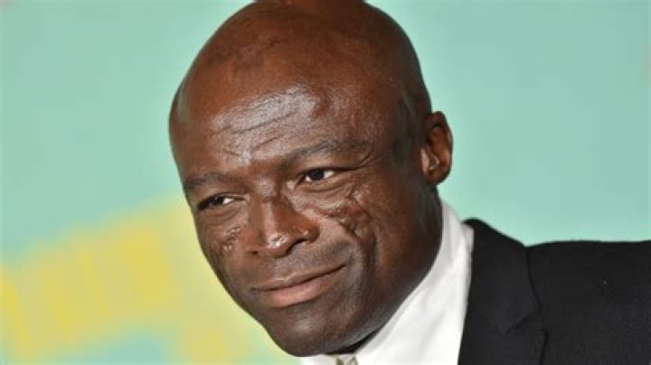 What happened to Seal’s face? The Mysteries Behind the Singer’s Battle Marks