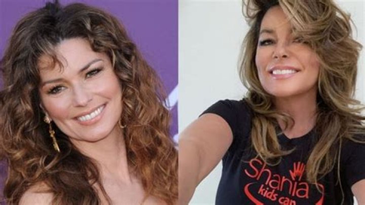 What Plastic Surgery Has Shania Twain Had? Singer’s Face Details And Several Throat Operations