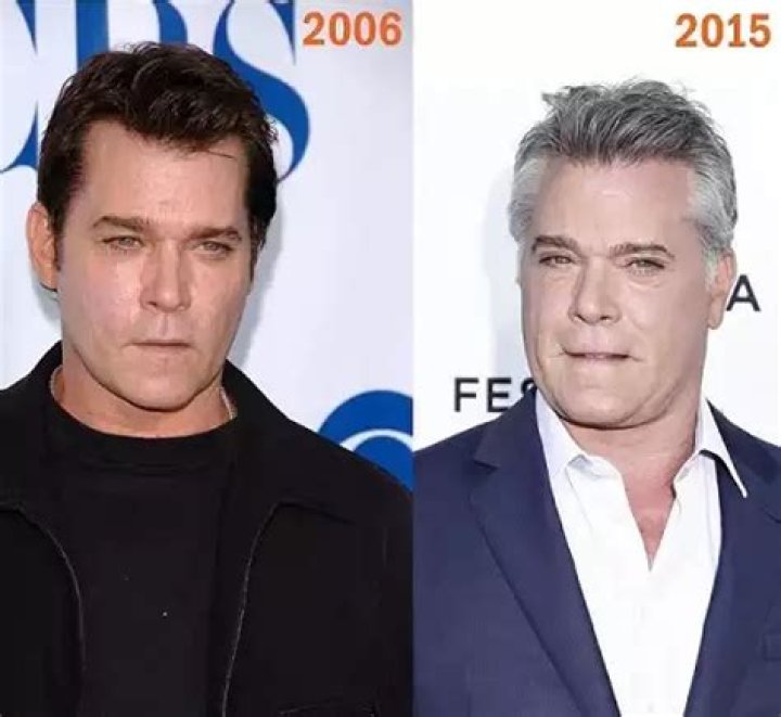 ‘What the hell happened to Ray Liotta’s face?’ Fans bemused as actor hits SAG Awards – The Sun