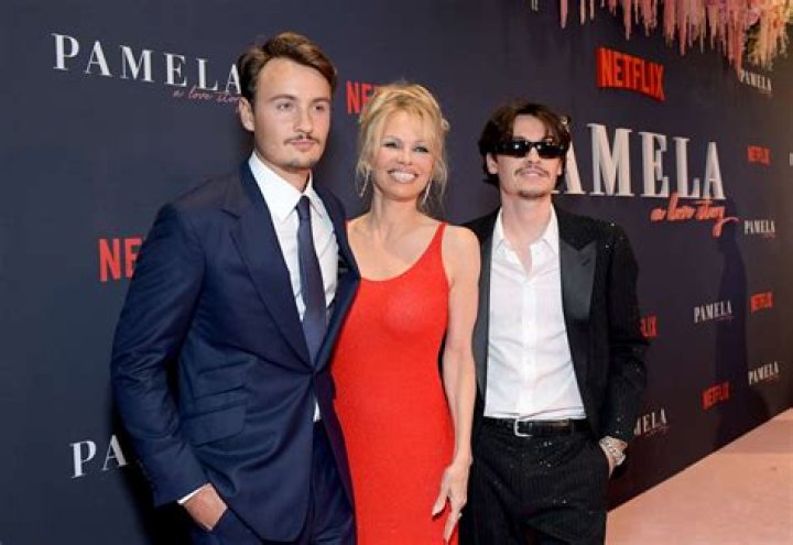 Why Does Pamela Anderson Have an Arm Mark?