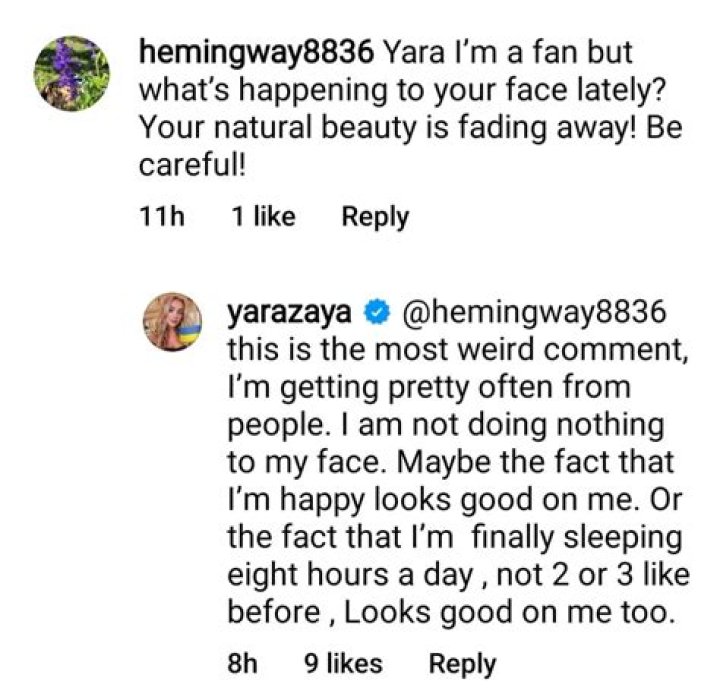 Yara Zaya responds to plastic surgery rumors: ‘Doing nothing to my face’