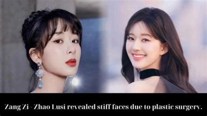Zhao Lusi Plastic Surgery: Exploring the Rumors About Zhao Lusi’s Plastic Surgery!!